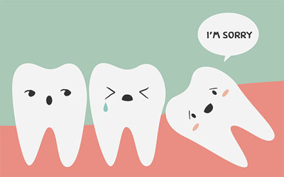 normal wisdom tooth extraction